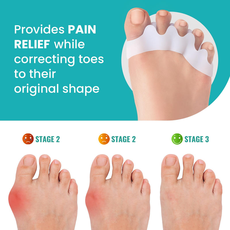 [Australia] - Silicone Toe Separators for Correct Bunion - 8 Pack Promifun Toe Spacers for Feet Men - Hammertoe Straighteners for Women-White 
