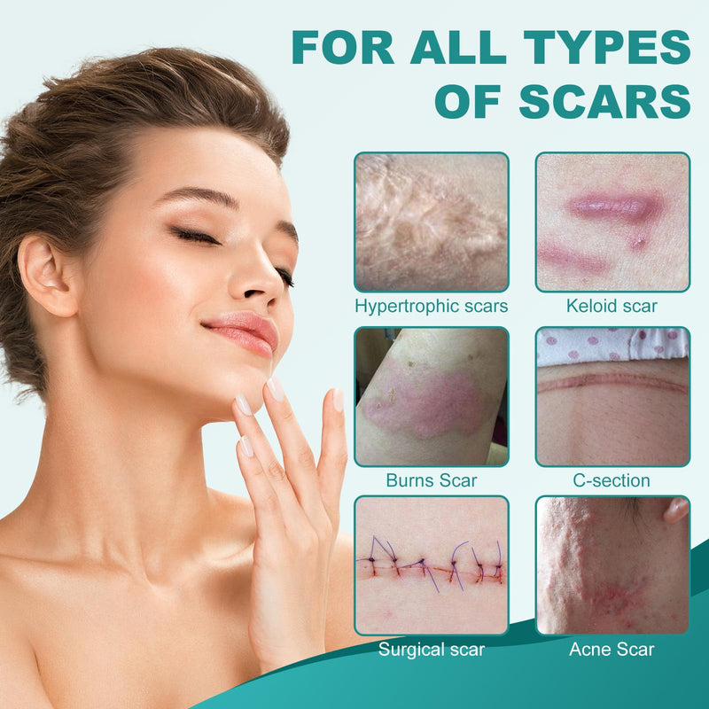 [Australia] - Silicone Scar Sheets, Silicone Scar Tape(1.6"x 158"), Scar Tape for Scar Removal Treatment, Reusable Silicone Scar Strips for Surgical, C-Section, Keloid, Burn, Acne, Surgical Scars 1.6"x 158" 