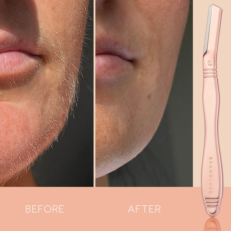 [Australia] - Dermaplaning Tool for Face, Eyebrow Shaping, Hair Removal and Exfoliation. Eco-friendly design. Includes 3 Swedish stainless steel blades in RoseGold (Starter Kit) Rose Gold 