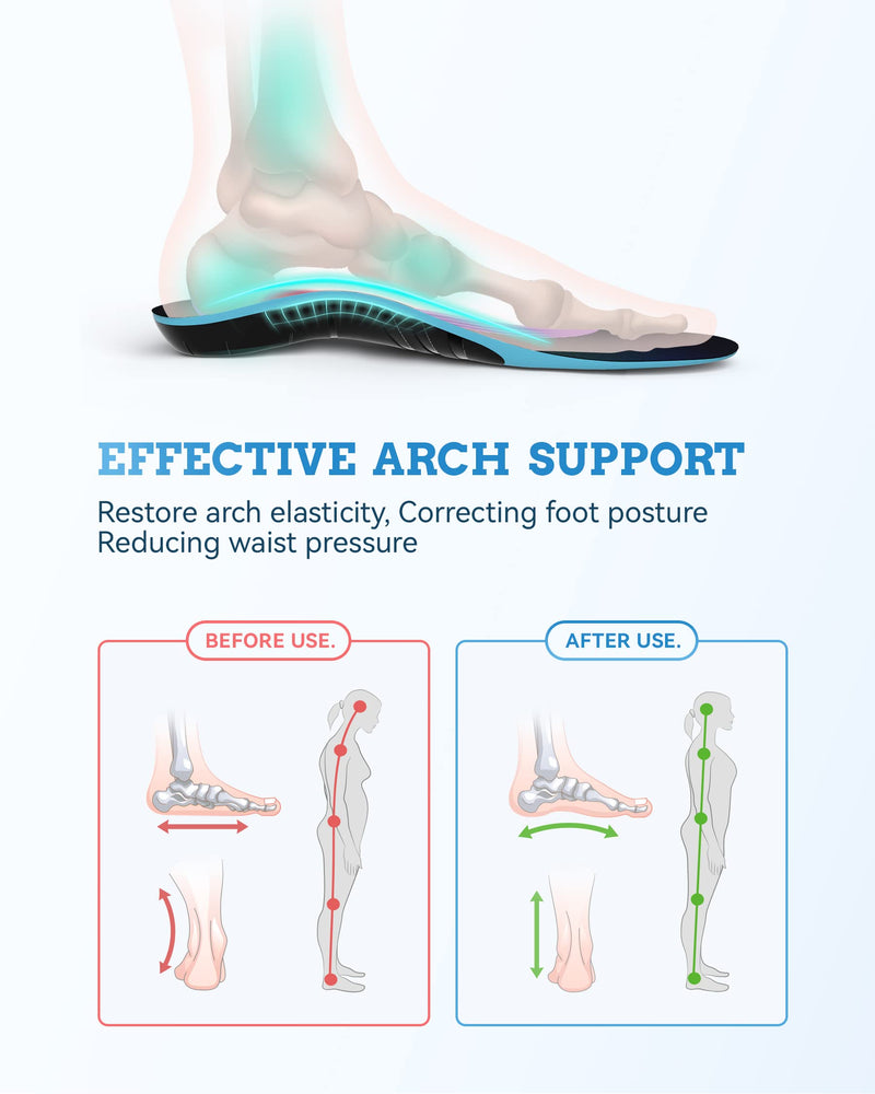 [Australia] - Arch Support Inserts, QBK Plantar-Fasciitis is Designed to Alleviate Pain and Discomfort Related to Plantar Fasciitis, Heel Spurs, Achilles Tendonitis, Metatarsalgia, Hallux Valgus, and Back Pain, L Blue L:(Men11-12.5 ) 