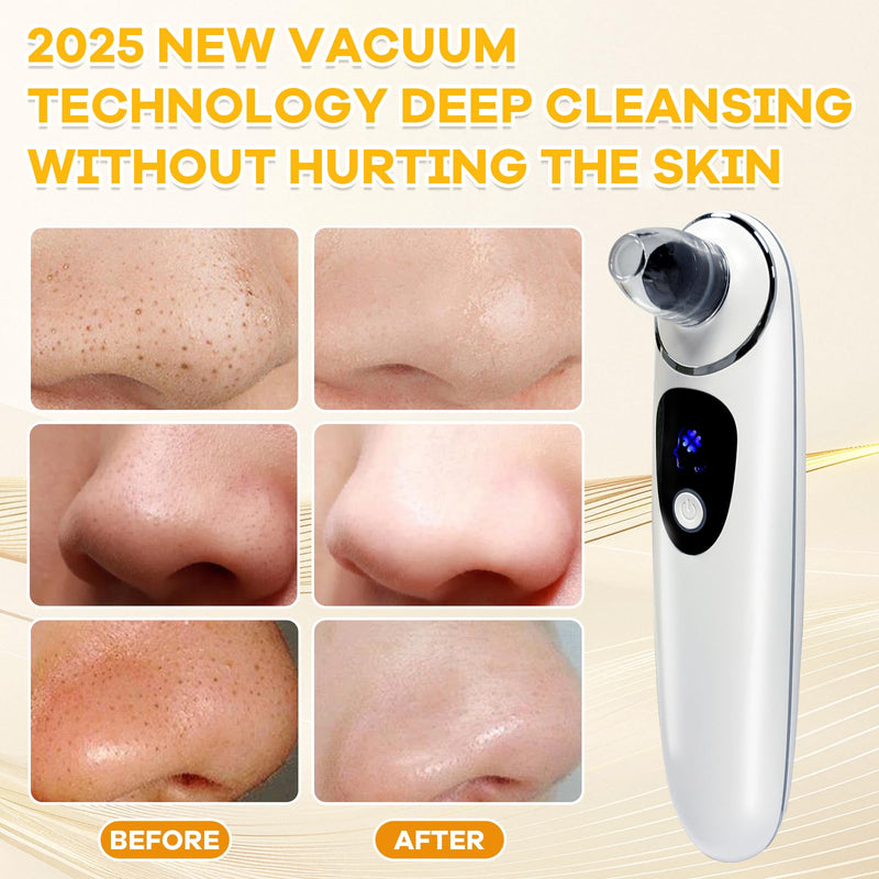 2025 Pore Vacuum with Camerafor, USB Rechargeable Blackhead Remover Vacuum,3 Levels Adjustable Pore Vacuum Blackhead Remover, 6 Suction Heads,Face Vacuum Pore Cleanser for Women & Men White