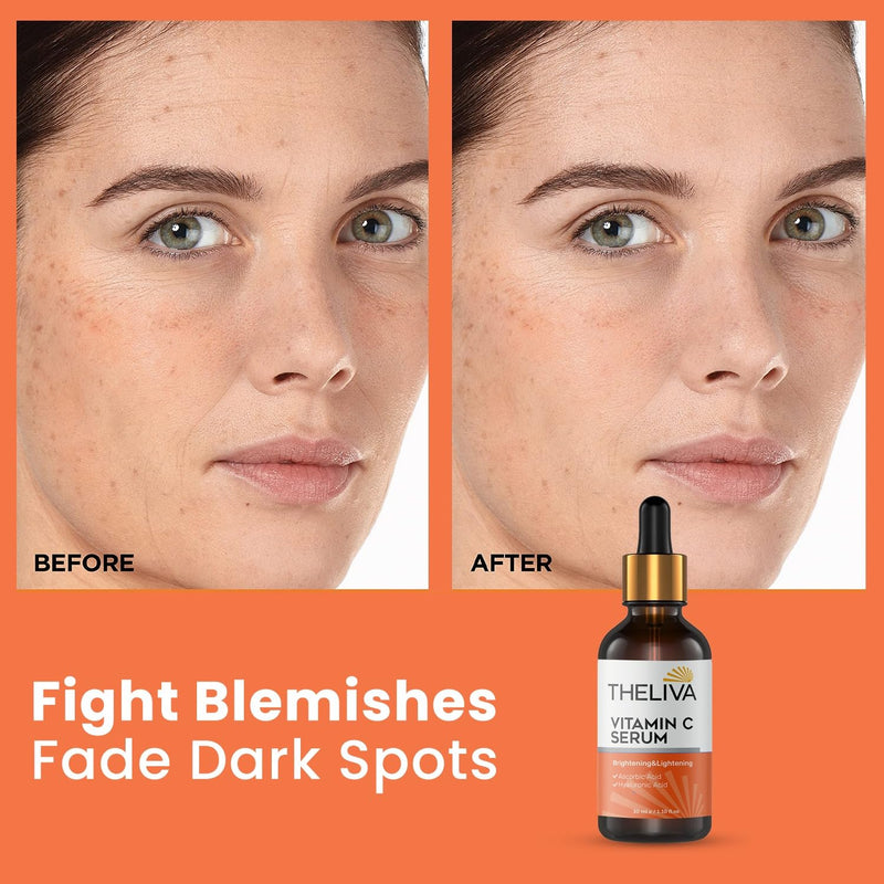 Vitamin C Serum for Face – Brightening & Hydrating with Hyaluronic Acid – Helps Improve Appearance of Wrinkles & Dark Spots – Radiant Skin Support – 1.10 fl oz