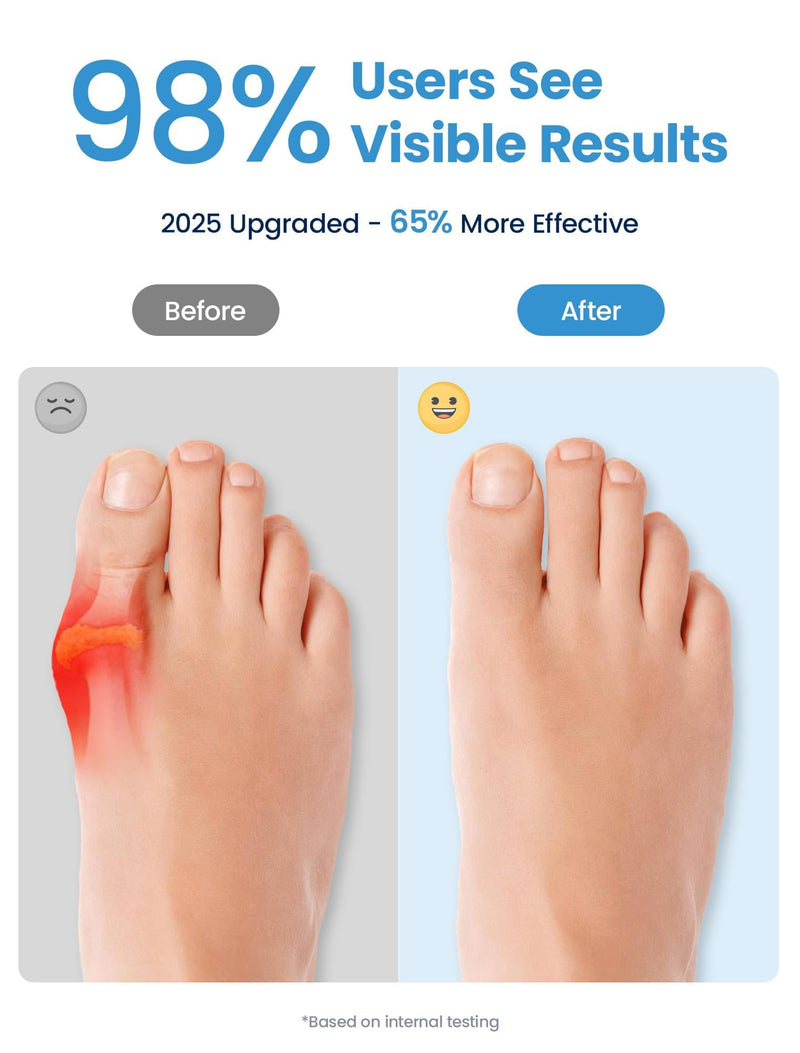 [Australia] - Bunion Corrector for Women and Men, Breathable Big Toe Straightener, Bunion Relief Splint & Pad, Comfortable for Day/Night Use, Fit for R/L, Washable Black-M-2Pack 