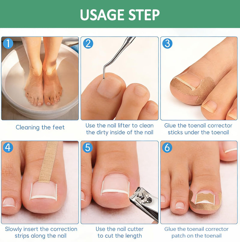 Professional Ingrown Toenail Treatment Set with Breathable Ingrown Toenail Strips,Ingrown Toenail Removal Kit,Curved Toenails Corrector Patch, Ingrown Toenail Corrector Tool Set for Home Use