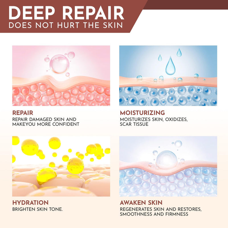 [Australia] - Silicone Scar Sheets - Silicone Scar Tape (1.6"x 120" Roll-3M) - keloid bump removal - Reusable And Effective Scar Removal Strips - Silicone Tape for Scars, Keloid, C-Section, Acne et 