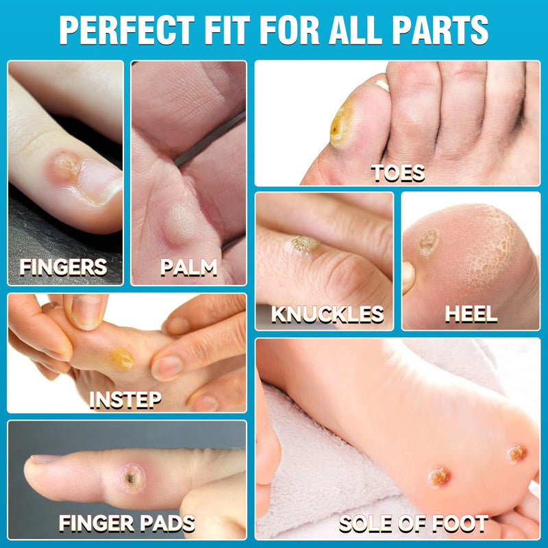 [Australia] - AstraVox 24Pcs Corn Removers for Toes Feet with Adhesive PU Waterproof Membrane, Plantar Corn Remover Bandaid Pads Kit for Hand, Highly Effective, Pain Relief, Easy to Use (Large) Large 