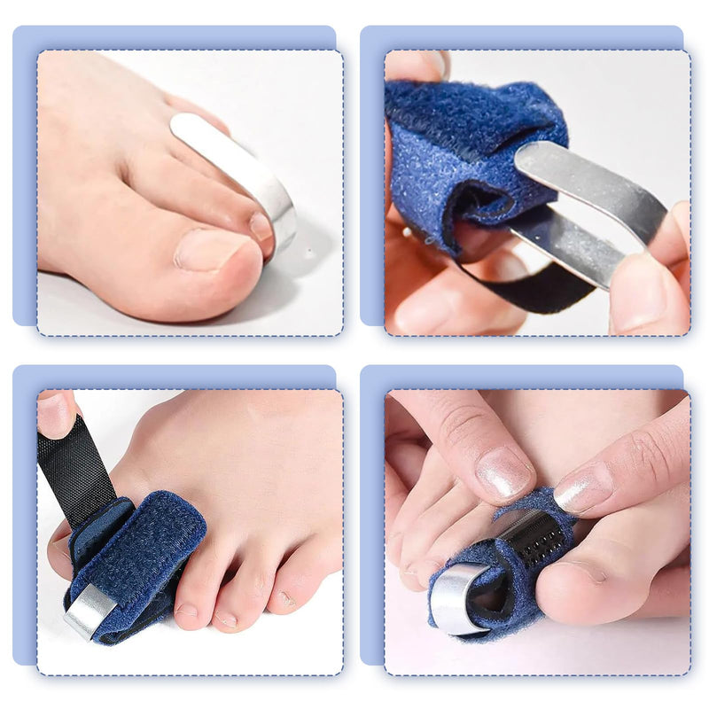 [Australia] - Hammer Toe Correction Pack of 3 Toe Splint Claw Toe Correction Toe Orthosis Claw Toe Toe Straightener Finger and Toe Fixation Support Straps for Alignment and Support of the Toes (Blue) 