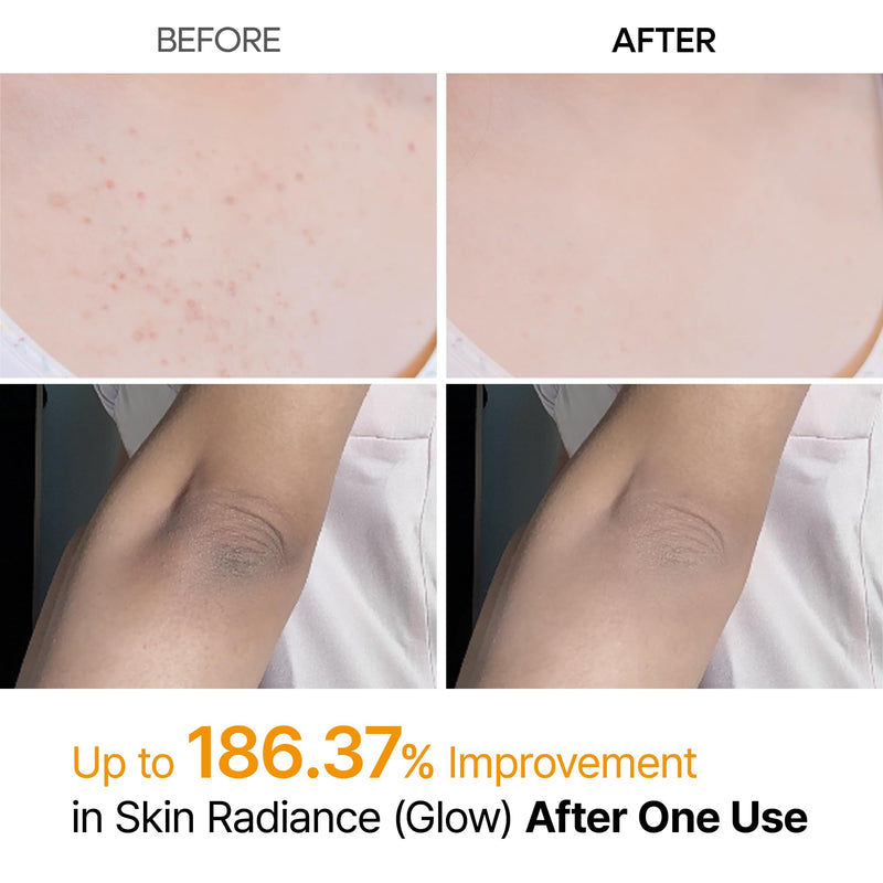 [Australia] - Body Peel Shot Spray Face Peeling Kojic Acid Turmeric Spray 200ml 