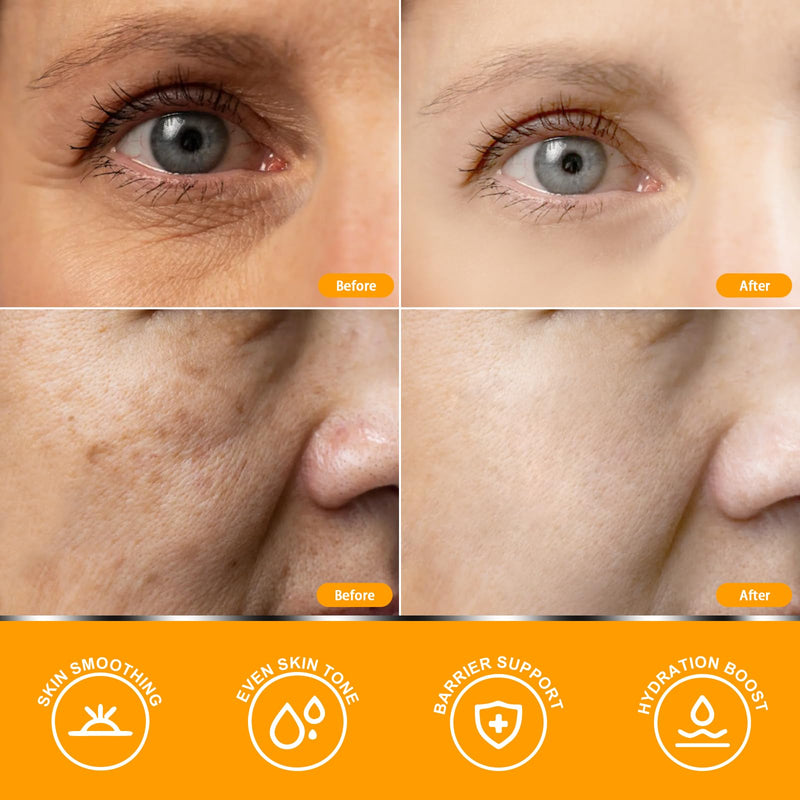 Super Vitamin C Face Serum for Women Over 70, Large Size 1.7 fl oz (50ml) - Fragrance-Free Multi-Tasking Age Defying Hydrating Complex for Mature Sensitive Skin 1.69 Fl Oz (Pack of 1)