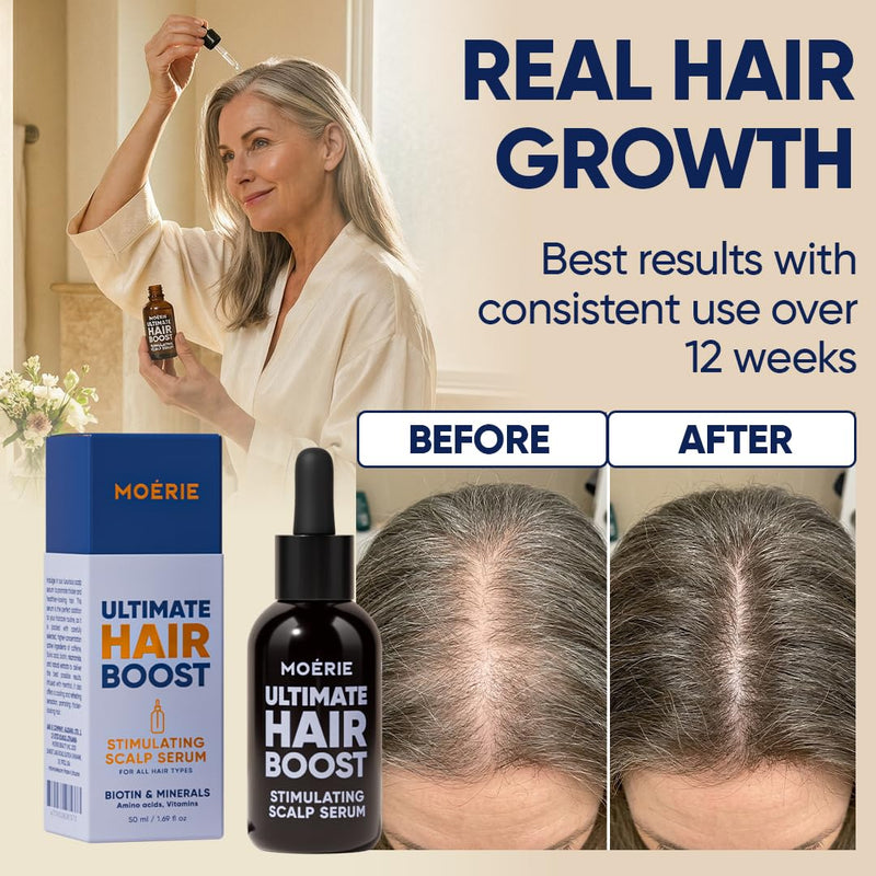 MOERIE Ultimate Hair Growth Serum for Natural Hair Regrowth & Thickening - Anti Thinning & Hair Loss Treatment for Women - Rapid Hair Growth Products - Scalp Oil Alternative - 1.69 fl oz / 50 ml Set of 1