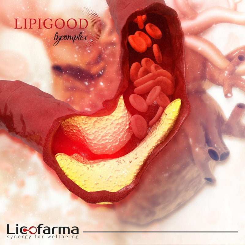 Lipigood Lycomplex Cholesterol Supplement | Fermented Red Rice | Monakolin K, Choline, Lycopene, Polycosanols, Artichoke, Coenzyme Q10 | Folic Acid, Vitamins B6 and B12 | 30 Capsules