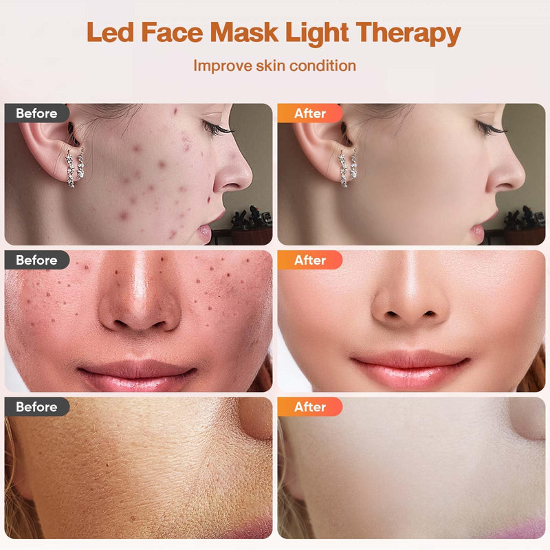 [Australia] - Red Light Therapy For Face, 7 Modes Portable Therapy Mask With 3000mah Rechargeable Remote, Blue, Orange, 850nm Infrared & Red Light Mask, 400 Leds For Anti-Aging 