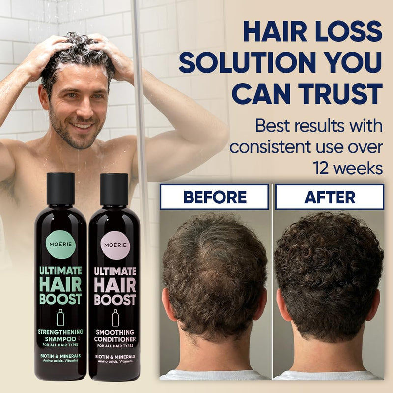 Moerie Hair Growth Shampoo and Conditioner for Women and Men, Hair Loss Solution with Biotin and Rosemary, Thickening Shampoo and Conditioner for Thinning Hair – Promotes Regrowth Single set