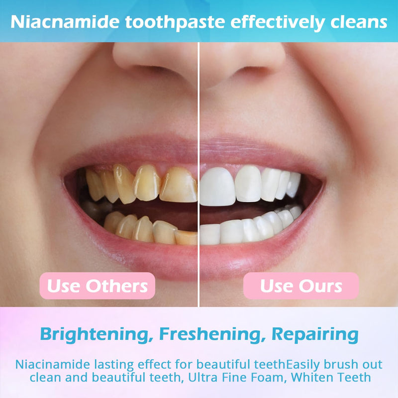 [Australia] - Niacinamide Whitening Toothpaste, Niacinamide Toothpaste Intensive Whitens Teeth, Protects Enamel, Removes Stains & Refreshes Breath, Daily Oral Care at Home Mint Flavor (3 Pack) YanxiananYagao 1 Ounce (Pack of 3) 