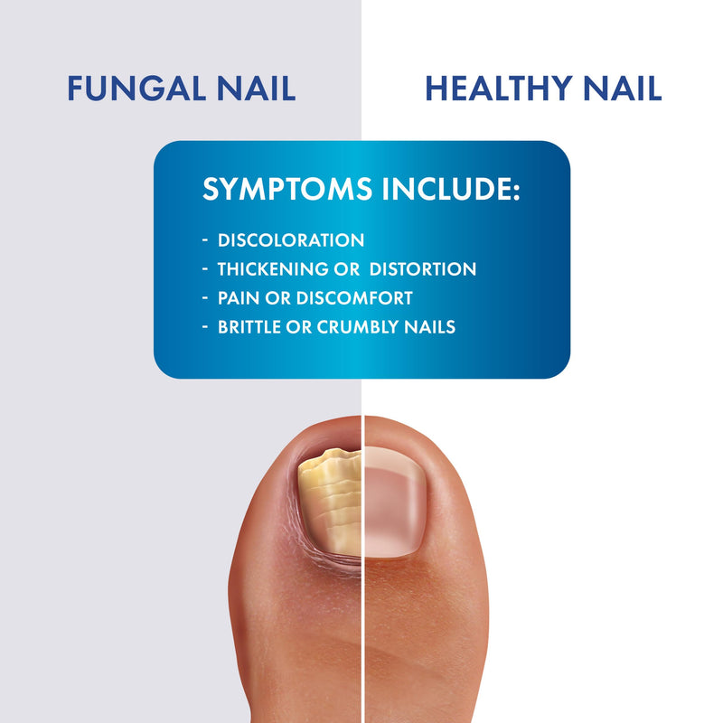 Fungal Shield Max Strength Brush-On Antifungal Liquid, 2-Pack | 2-pack brush-on antifungal liquid for max strength fungal relief, precise no-mess application