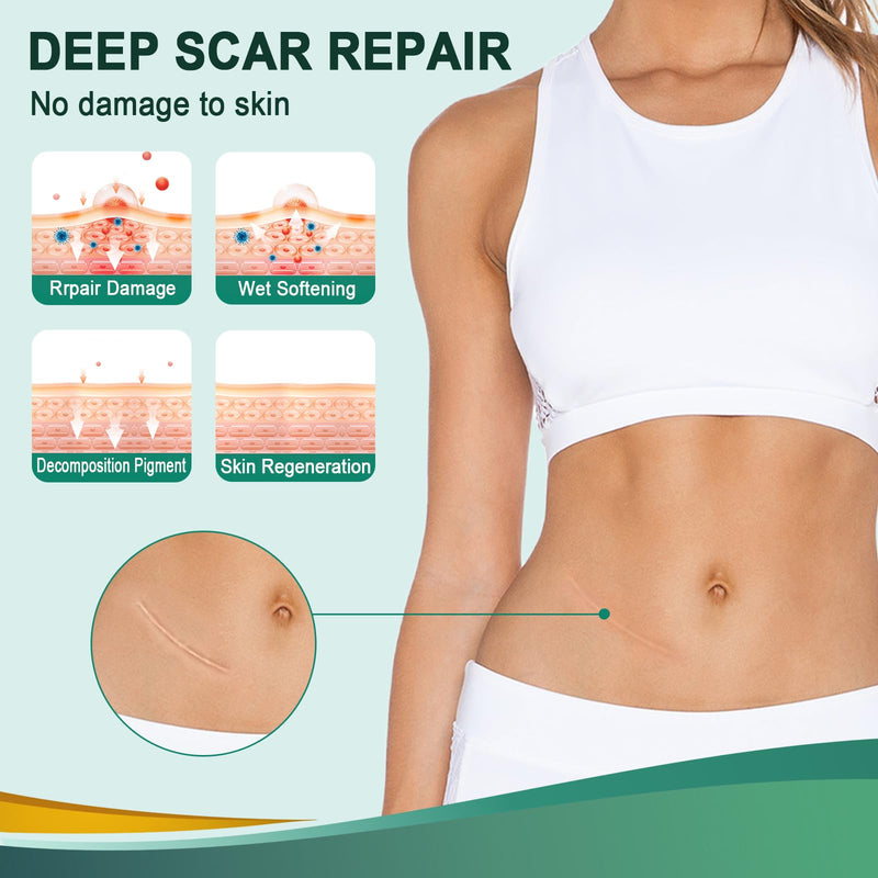 [Australia] - Silicone plaster for scars, professional scar plaster, reusable (4cm x 150cm) 4cm x 150cm 