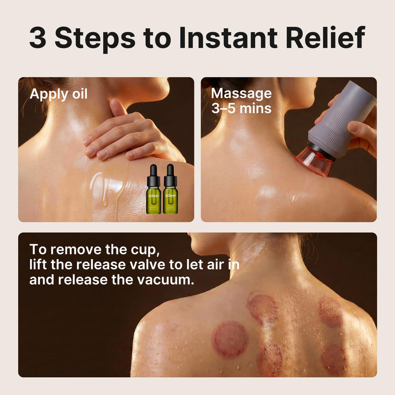 Cupping Set, Electric Cupping Kit for Massage Therapy, Lymphatic Drainage Massager with Heat, 6 Levels for Muscle Relaxation, 4 Cups + 2 * 10ml Essential Oil 1 Device + 2 Essential Oils + 4 Cups