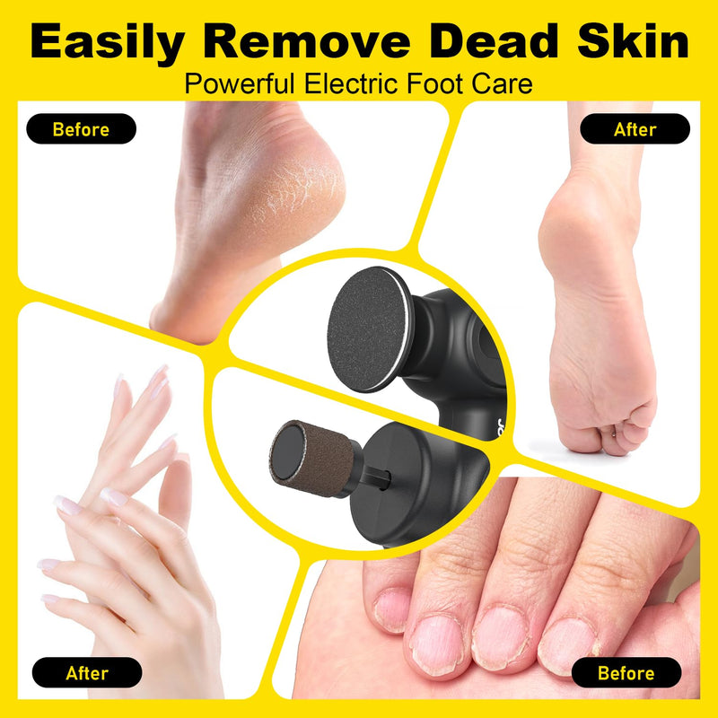 [Australia] - Electric Foot Callus Remover Rechargeable, Electronic Foot File Pedicure Tool, 2 in 1 Foot Grinder, Pro Foot Scrubber Kit for Dead, Hard, Cracked Skin, with 6 Speeds & 20 Sandpaper Discs 