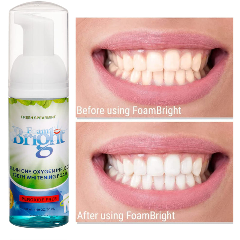 Retainer Foam Cleaner & Teeth Whitening Formula. The Ultimate Cleaning Toothpaste for Aligner Retainers. Great for All Kinds of Clear Retainers, Braces & Aligners. Safe for Dentures. (2 Pack)