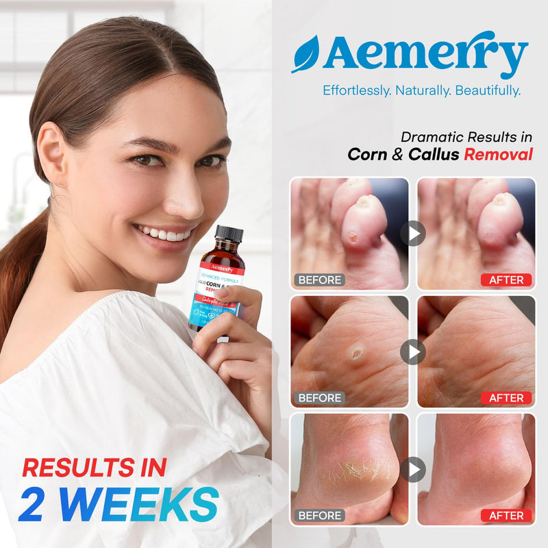 [Australia] - Corn Removers for Toes Foot: Liquid Salicylic Acid 17% Corns Calluses Removal Extra Strength, Fast Acting Corn Remover for Feet Fingers. 30ml 