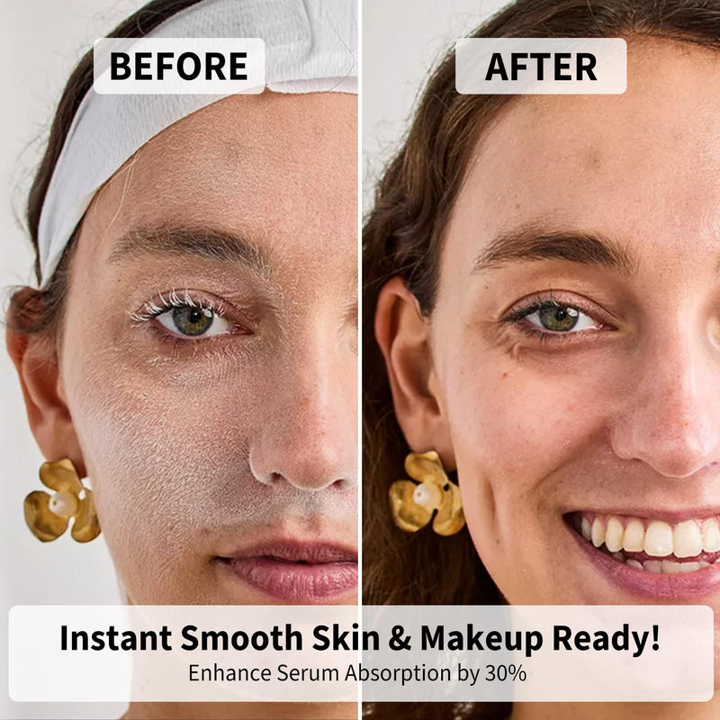 Dermaplane Razor for Women Face, Precision Face Razors for Women, Dermaplaning Tool, Gentle Exfoliation, Perfectly Shape Brows, Reusable Metal Handle with 8 Microblades, Beige Beige with 8 Refills