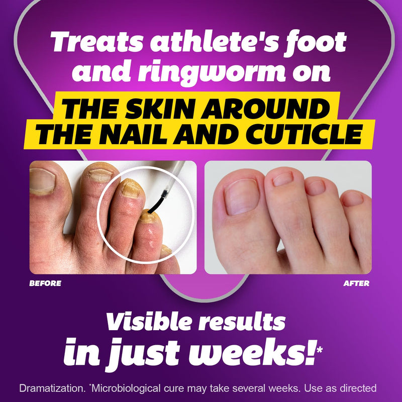 SILKA Max Strength Antifungal Liquid for Toenail Health with Brush Applicator, Results in 1 Week, Nail Fungus Treatment for Damaged Toenails, Athlete's Foot Treatment, Tolnaftate 1% 0.45 Fl Oz 0.45 Fl Oz (Pack of 1)
