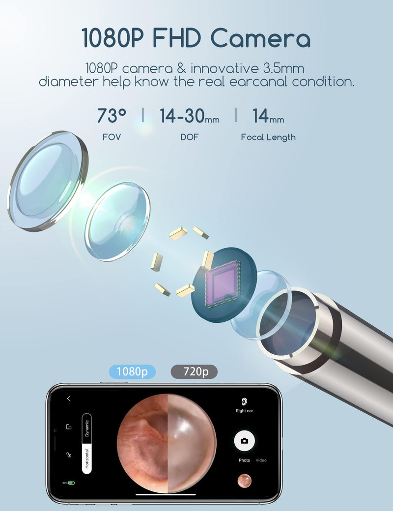 [Australia] - Earwax Remover Otoscope, Qimic WiFi Ear Cleaner, 1080P Ultra Thin HD Wireless Waterproof Ear Mirror with 3.5mm Lens and 6 LEDs for iPhone, iPad and Android Smartphones 