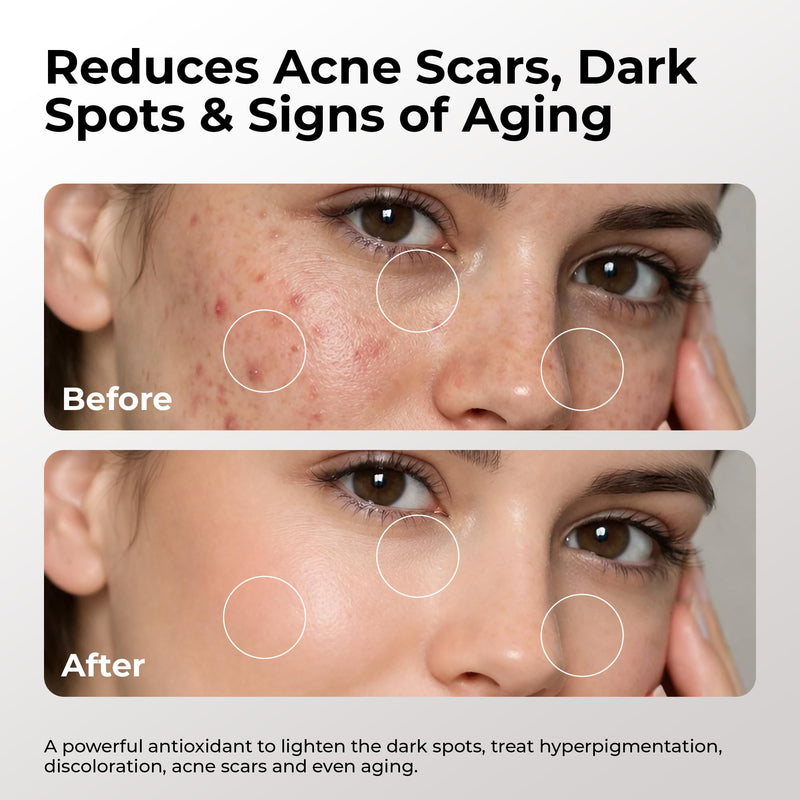 Skin Deva 20% Vitamin C Serum Anti Aging with Hyaluronic Acid & Vitamin E Ferulic Acid - Brightening Formula for Improving Appearance of Dark Spots, Fine Lines & Wrinkles - All Skin Types, 1 fl oz 1 Fl Oz (Pack of 1)