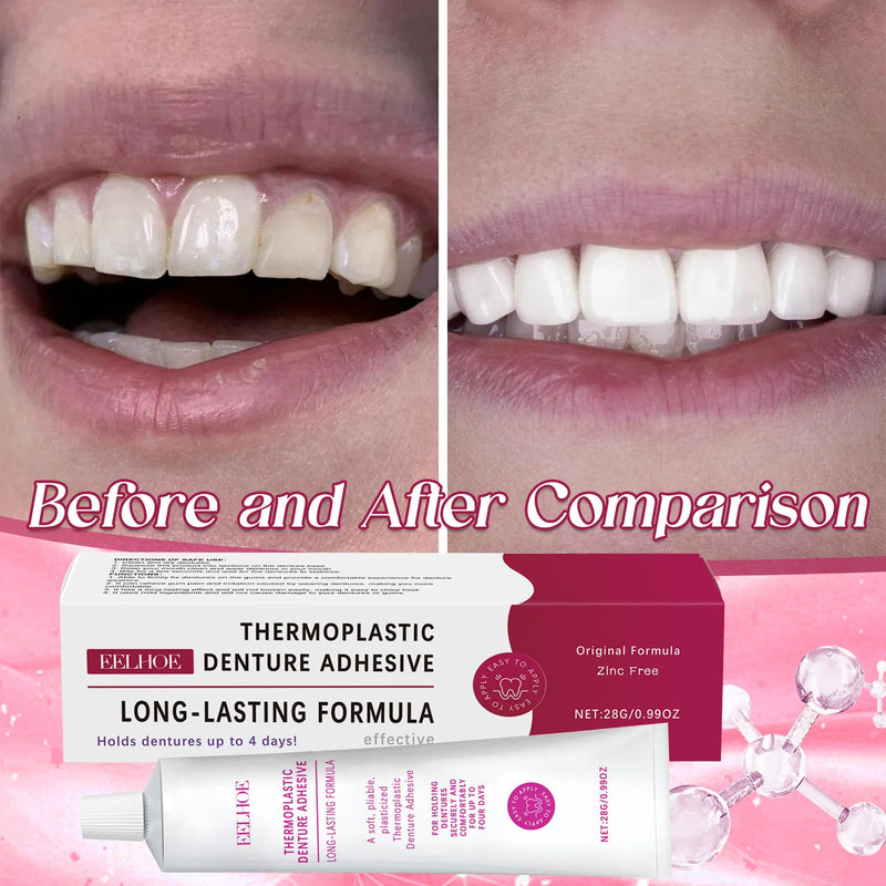 [Australia] - Denture Adhesive Gel Thermoplastic Denture Adhesive Denture Glue Denture Adhesive Adhesive Cream for Dentures Thermoplastic Denture Adhesive (Pack of 1) 
