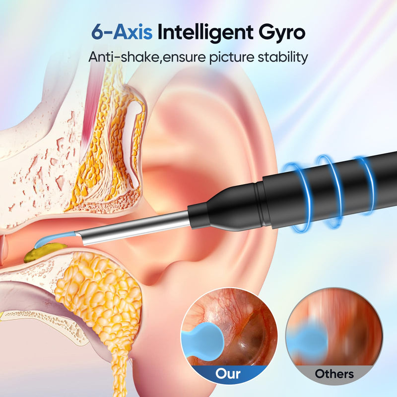 [Australia] - Ear Wax Removal Tool Camera with 8 Kits & 5 Ear Spoon, Ear Cleaner with Camera 1080P HD, Earwax Removal Kit with 6 LED Lights, Ear Wax Removal Kit for iOS & Android Black 