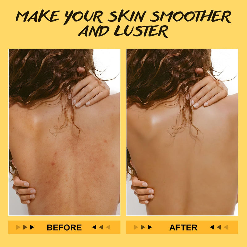 [Australia] - POP MODERN.C Turmeric and Vitamin C Body Scrub Remove Dead Skin Improve Dark Spots Acne Natural Organic Exfoliating Deep Cleansing Exfoliator for Body Butt Bikini Area Body Care with Loofah 