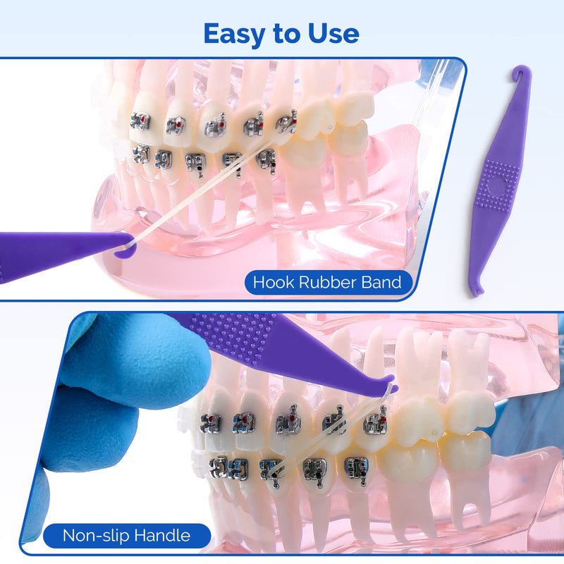 [Australia] - JMU Orthodontic Elastics 5/16 Medium, 500 pack Latex Intraoral Elastic Bands Latex Dental Rubber Bands Made in USA, Amber 