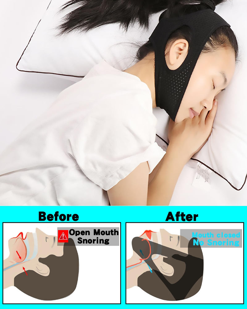 [Australia] - Anti Snoring Chin Strap，Chin Lipo Compression Garment，Post Surgical Chin Strap，Anti Snoring Devices Chin Strap for Men&Women(Black) Black 