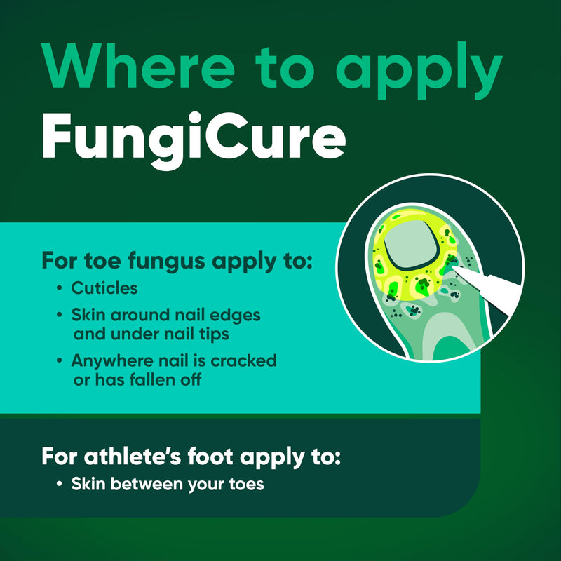 FUNGICURE Medicated Liquid Gel - Maximum Strength 0.35 Fluid Ounce | Cures fungal infections & kills 6 types of fungus. Clinically proven clotrimazole 1%. Easy, precise, no-mess application.