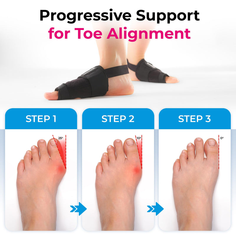 [Australia] - Effective Corrector for Women and Men | Relief Kit, Straighten Toes, and Correct Alignment | Cushion Sleeves | Feet Support - Small/Medium 2 Pair (S/M) 