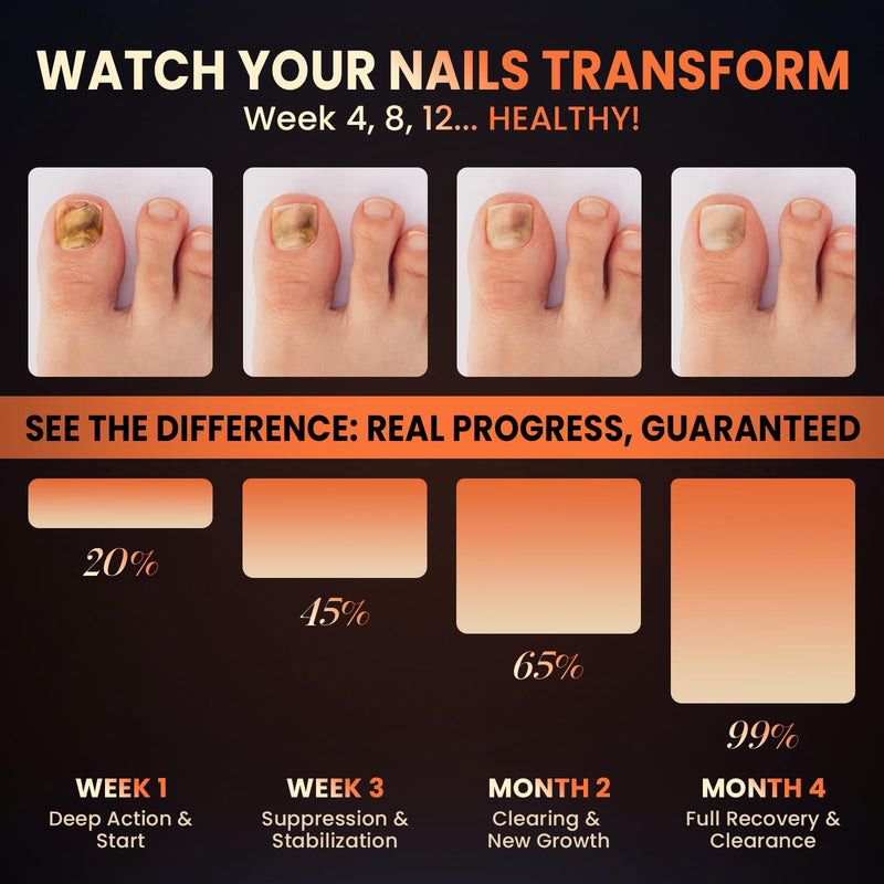 Toenail Fungus Treatment Extra Strength Pen for Toenail & Finger, More Pure Natural Plant Extracts, Toe Nail Fungus Treatments for Damaged Nail