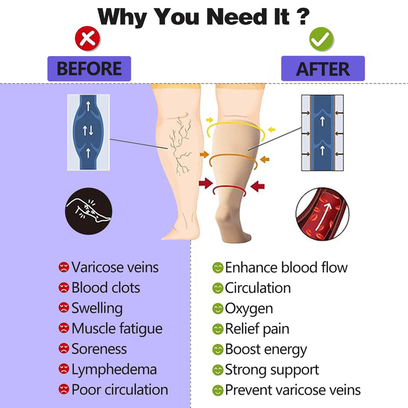 [Australia] - Sheer Compression Stockings for Women, 15-20 mmHg Knee High Circulation Support Stockings, Graduated Medical Compression Socks for Travel, Flight L Beige-Open Toe 