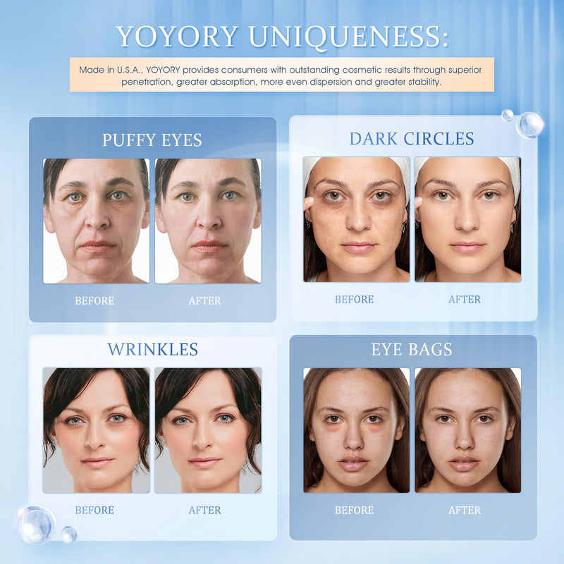 [Australia] - Under Eye Patches Masks - for Dark Circles, Puffy Eyes, Fine Lines, Wrinkles, Eye Bags Treatment with Collagen and Hyaluronic Acid, Moisturizing and Hydrating (60 Pcs)… Cornflower Blue 