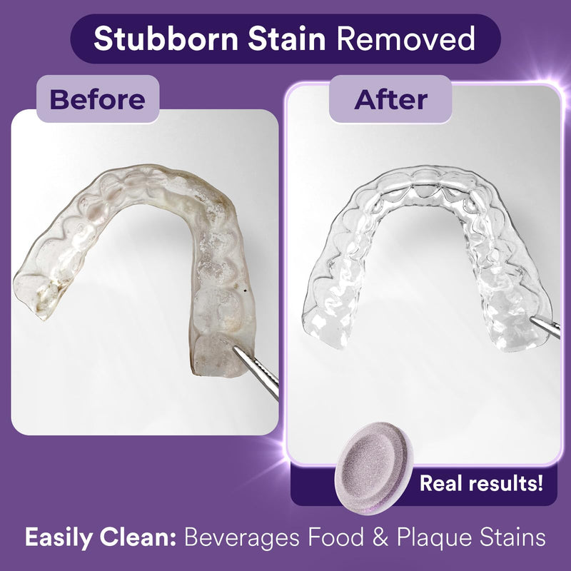 [Australia] - Retainer Cleaner Tablets, Invisalign Cleaner, Remove Stains, Odors & Plaque, Night Guard Cleaner, FSA & HSA Eligible, 1-Month Supply, Denture Cleaner, 30 Tablets, Grape-Scented 30 Count (Pack of 1) 