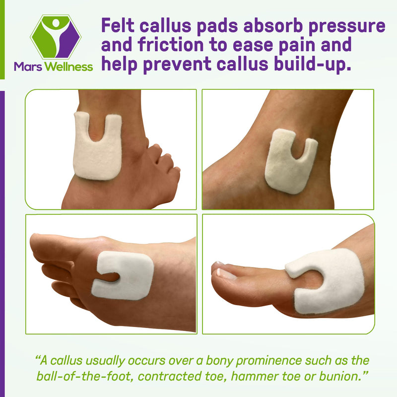 [Australia] - U Shaped Felt Callus Horseshoe Pads - Adhesive Foot Pads That Protect Calluses from Rubbing On Shoes - 3/16" - 25 Pack 
