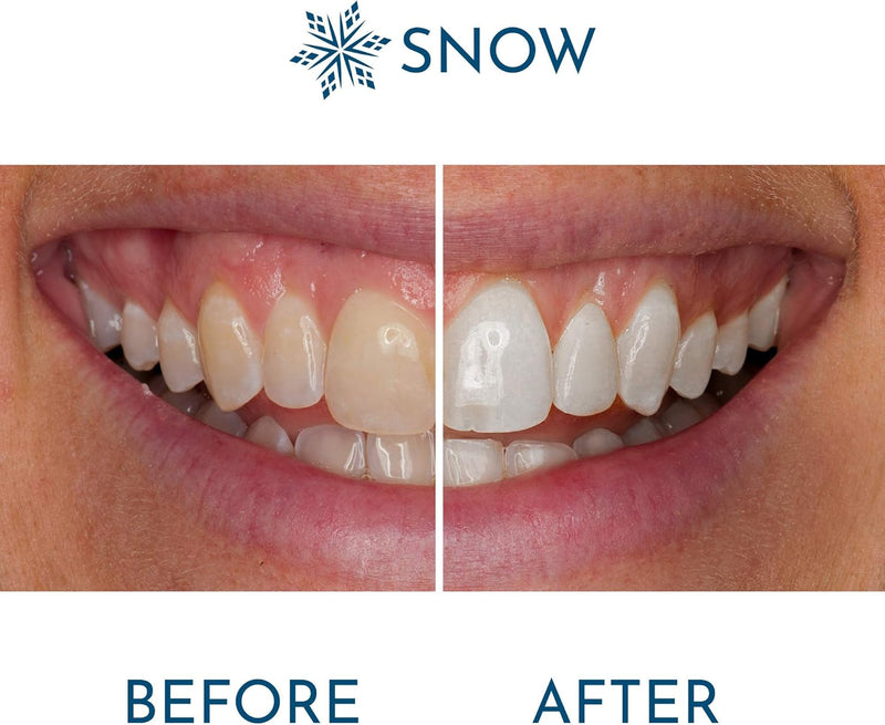 [Australia] - Snow Extra-Strength Teeth Whitening Pen, Enamel-Safe Tooth Whitening Pen for Sensitive Teeth, Teeth Whiteners for Oral Care, Stain Remover for Teeth That Visibly Whitens Tooth up to 8 Shades - 1 Pack 0.13 Fl Oz (Pack of 1) 