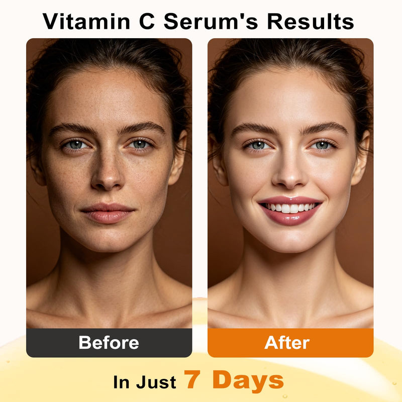 Vitamin C Serum for Face Brightening Face Serum with Pure Vitamin C | + Hyaluronic Acid + Niacinamide + Vitamin E for Hydrating, Antioxidant & Anti Aging Care, 30ml