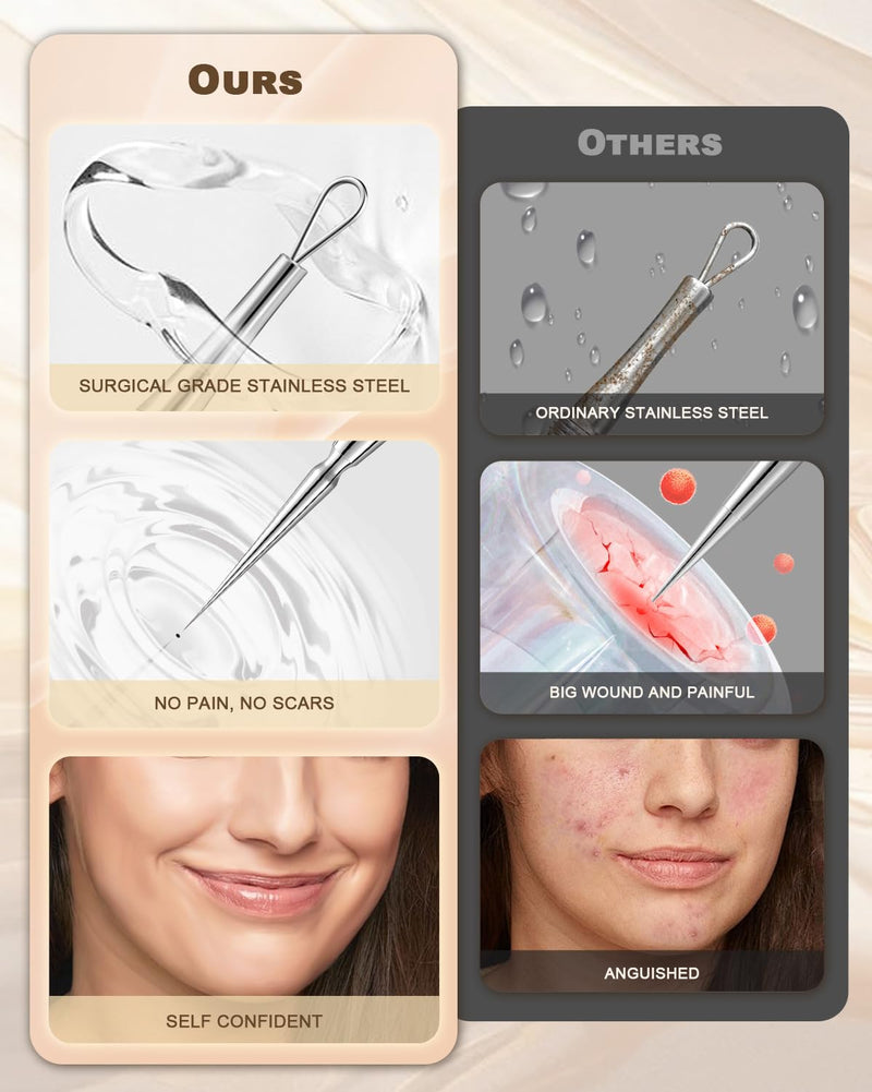 [Australia] - SGNEKOO Professional Facial Milia Removal Tool and Whitehead Extractor,Titanium Alloy Double Ended Needle and Steel Tweezers Kit,Blackhead,Blemish,Zit and Pimple Acne Remover Popper (Titanium Gold) Titanium Gold 