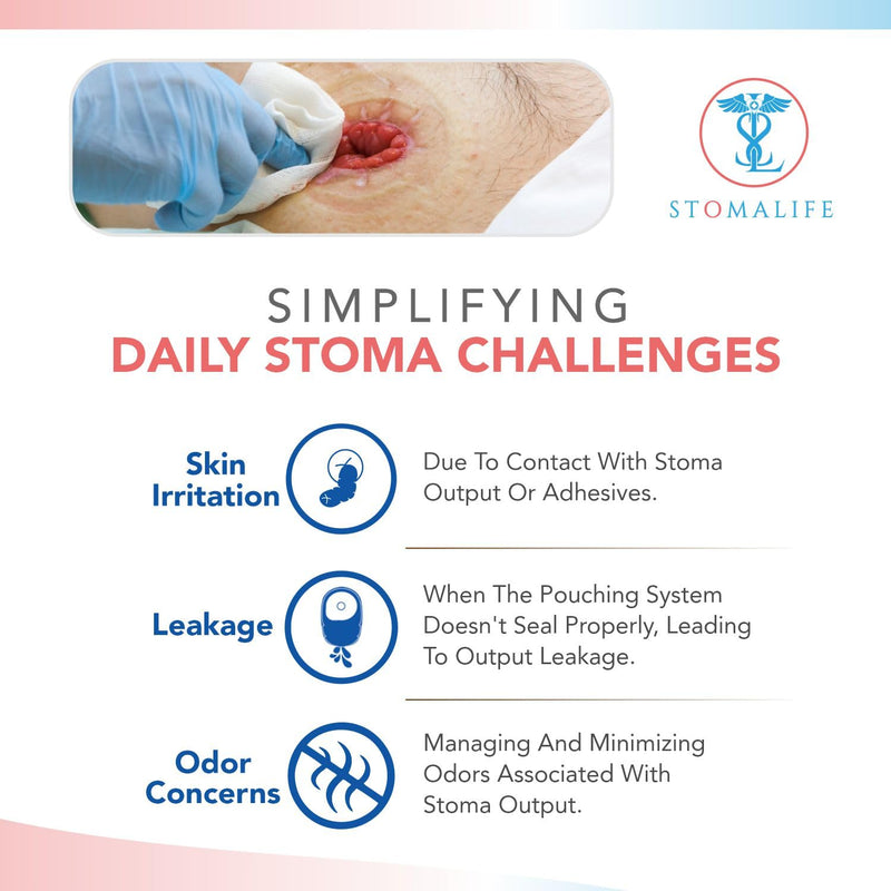 [Australia] - Ostomy Paste 2 Oz, Stoma Barrier Paste with Skin Irritation Prevention | Accessories for Ostomy-Colostomy-Ileostomy‚Ä¶ (2 oz (Pack of 1)) 2 Ounce (Pack of 1) 