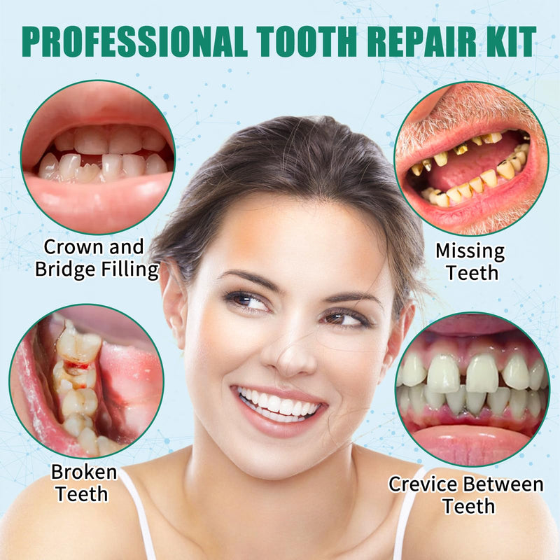 [Australia] - Temporary Replacement Tooth Repair Kit, Zinc Oxide Eugenol Cement Dental Care Kit Glue for Crowns & Bridges Filling, Perfect Smile (6) 