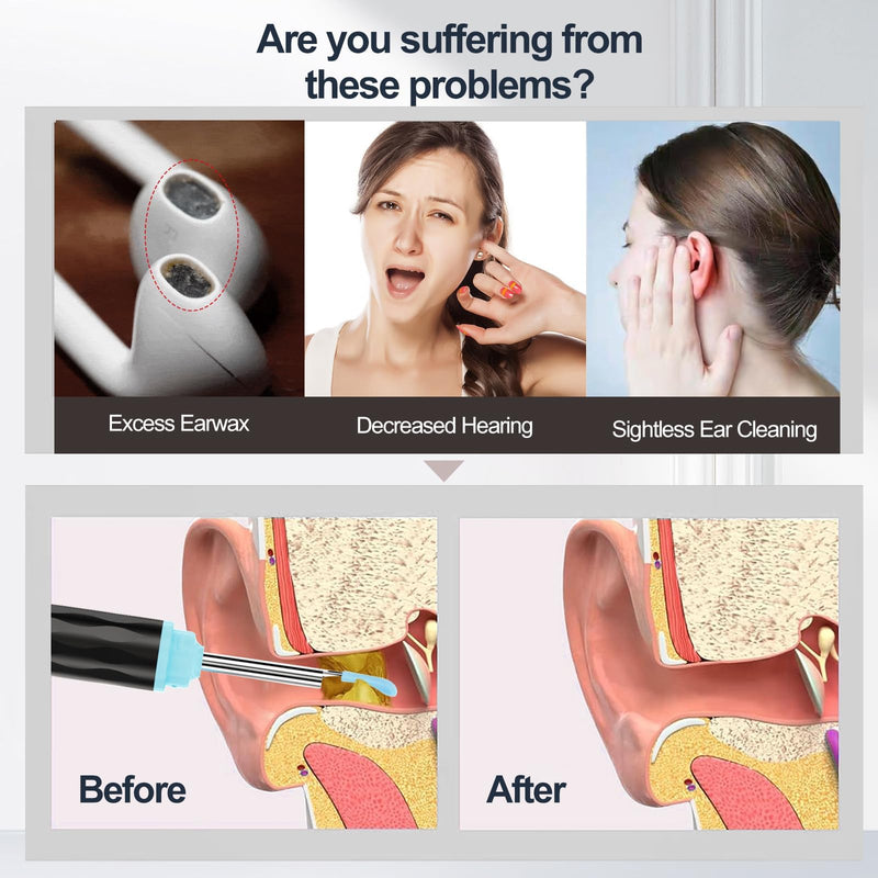 [Australia] - Ear Wax Removal, Ear wax removal tool camera built-in 1296P, Easy and Safe Ear Cleaning, Earwax Removal kit with 9 Ear Set and 8 Traditional Tools, Ear Cleaning Kit for iPhone, iPad, Android Black 