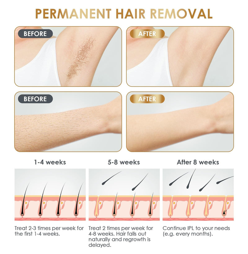 [Australia] - IPL Laser Hair Removal Device at-Home for Women Men NATRSYM Painless Permanent Facial Upper Lip Bikini Line Armpits Back Legs Arms Face Back Whole Body Remover JZF 