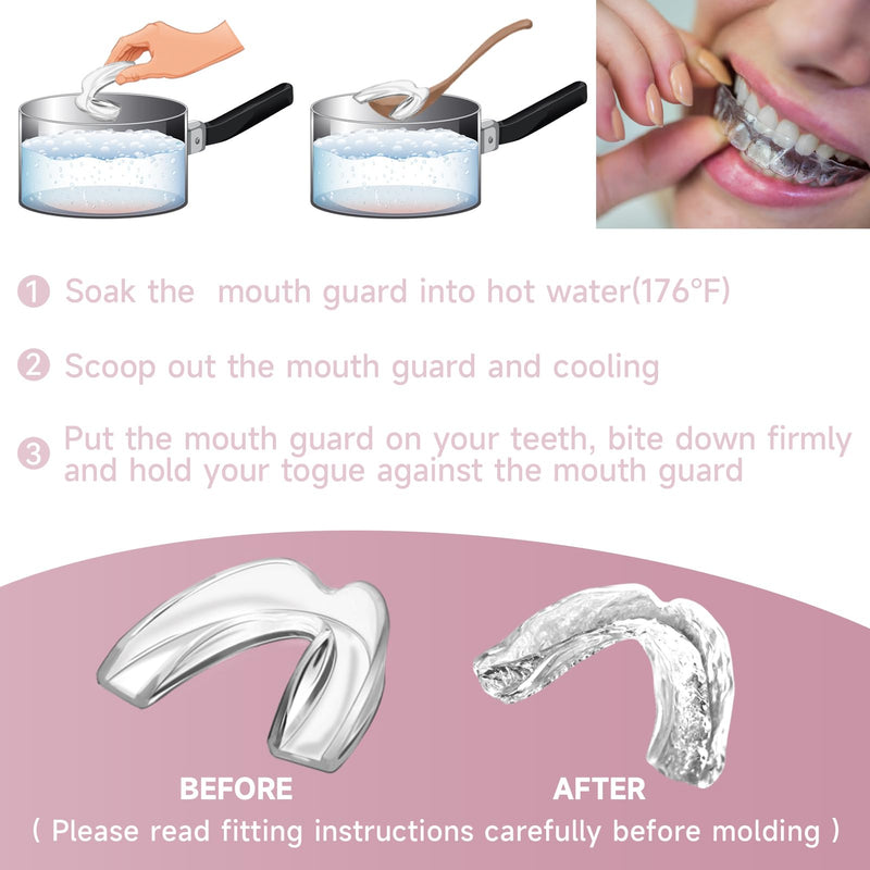 [Australia] - 4 Pack Pink Mouth Guards for Women and Teens, Medium Size, Moldable Night Guards for Teeth Grinding and Clenching, Comfortable Bite Guards, Stylish Custom Dental Guards for Protection 