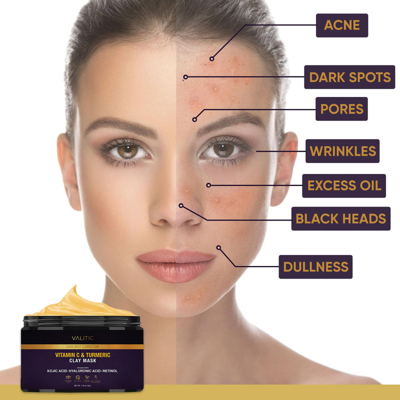 VALITIC Vitamin C & Turmeric Clay Mask - Dark Spot Corrector with Kojic Acid, Hyaluronic Acid & Retinol - Skin Care Routine for Minimizing Pores & Blackheads - with Applicator Brush - 50g 1.76 Ounce (Pack of 1)