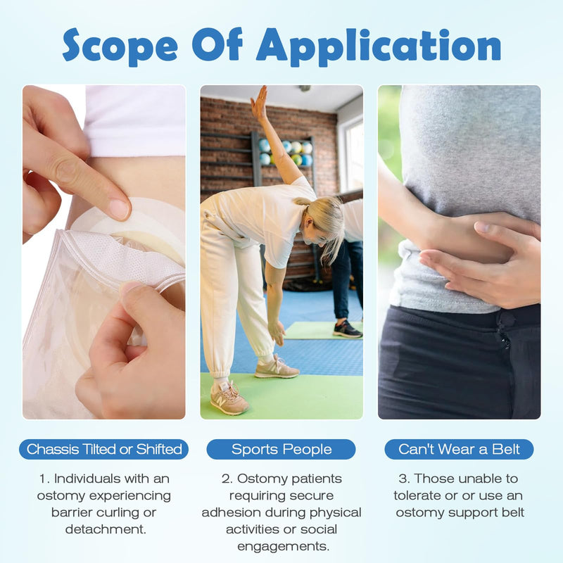 Tape Strips for Stoma Bags, 60pcs Ostomy Barrier Tape Strips for Stoma Bags, Breathable & Skin-Friendly Extenders Skin Barrier Tape - Stoma Care Product for Colostomy, Urostomy, Ileostomy Supplies